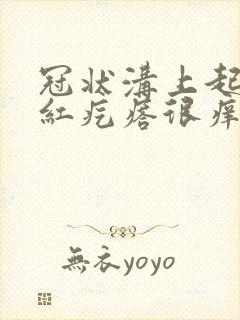 冠状沟上起一排红疙瘩很痒