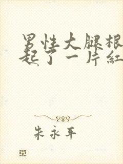 男性大腿根内侧起了一片红疙瘩很痒