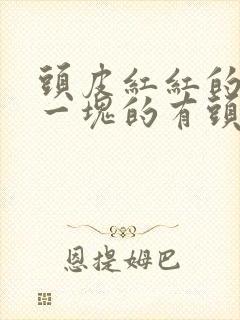 头皮红红的一块一块的有头皮屑