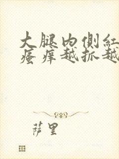 大腿内侧红疙瘩瘙痒越抓越痒