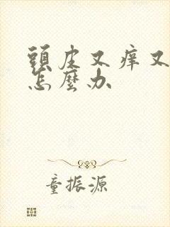 头皮又痒又掉发怎么办