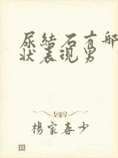 尿结石有哪些症状表现男