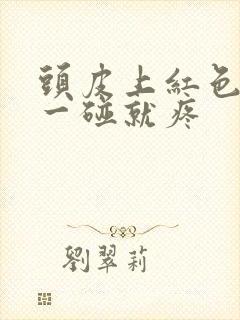 头皮上红色疙瘩一碰就疼