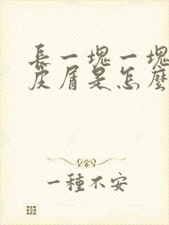 长一块一块的头皮屑是怎么回事