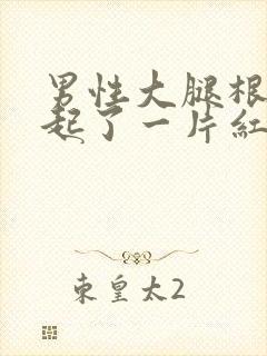 男性大腿根内侧起了一片红疙瘩很痒