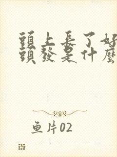 头上长了好多白头发是什么原因封面