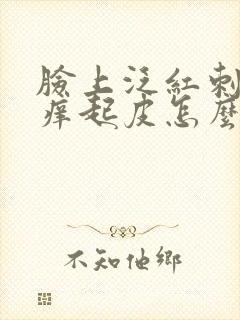 脸上泛红刺痛发痒起皮怎么办