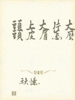 头上大片大片的头皮屑怎么回事怎么办