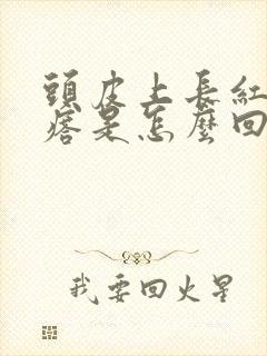 头皮上长红色疙瘩是怎么回事