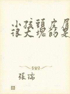 小孩头皮屑很多很大块的是什么问题