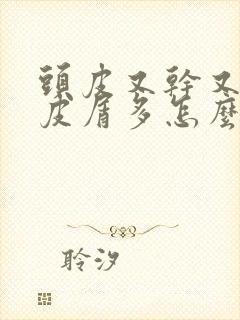 头皮又干又痒头皮屑多怎么办