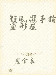 类风湿手指关节变形症