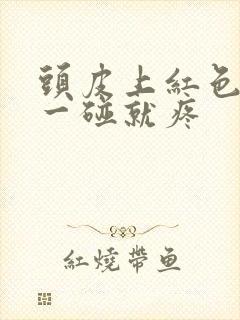 头皮上红色疙瘩一碰就疼