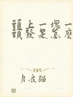 头上一块一块掉头发是怎么回事