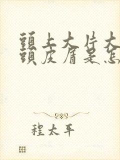 头上大片大片的头皮屑是怎么回事