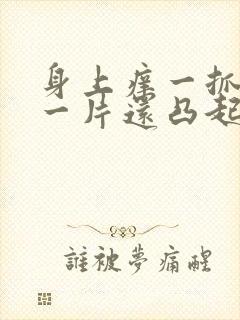 身上痒一抓就红一片还凸起用什么药