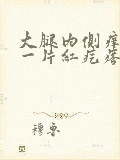 大腿内侧痒挠完一片红疙瘩