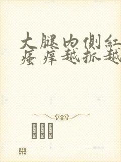 大腿内侧红疙瘩瘙痒越抓越痒