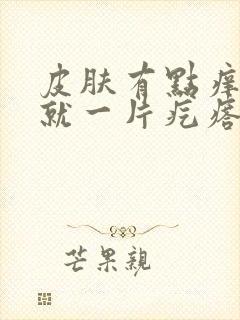 皮肤有点痒一抓就一片疙瘩封面