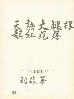 天热大腿根部痒起红疙瘩