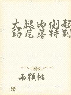 大腿内侧起红色的疙瘩特别痒封面