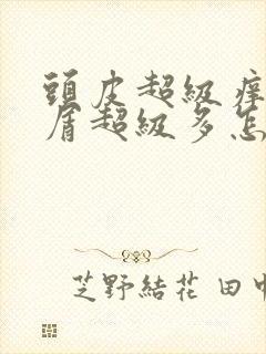 头皮超级痒头皮屑超级多怎么办