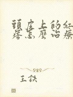 头皮上的红色疙瘩怎么治疗