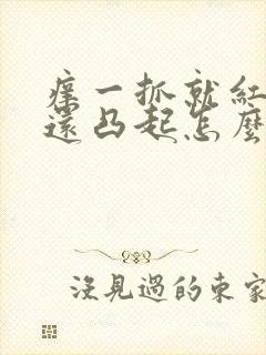 痒一抓就红一片还凸起怎么办