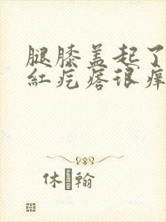 腿膝盖起了好多红疙瘩很痒封面