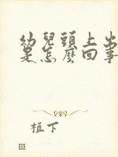 幼儿头上出汗多是怎么回事,头发都湿透了封面