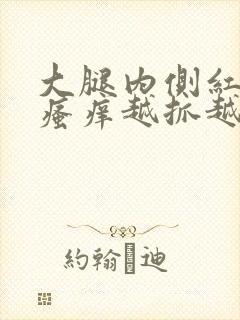 大腿内侧红疙瘩瘙痒越抓越多