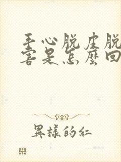 手心脱皮脱得厉害是怎么回事