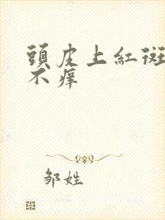 头皮上红斑不痛不痒封面