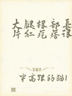 大腿根部长了一片红疙瘩很痒