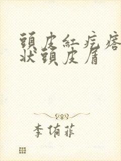 头皮红疙瘩有块状头皮屑