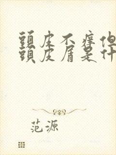 头皮不痒但是有头皮屑是什么原因