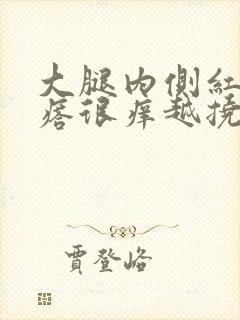 大腿内侧红色疙瘩很痒越挠越多