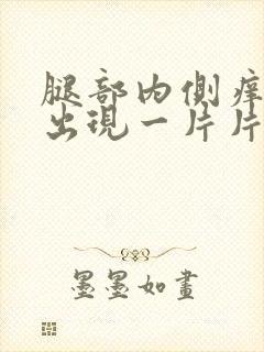 腿部内侧痒一挠出现一片片的疙瘩