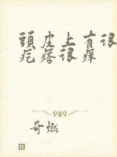 头皮上有很多小疙瘩很痒