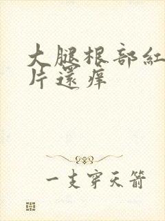 大腿根部红了一片还痒