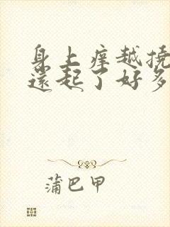 身上痒越挠越痒还起了好多疙瘩用什么药膏