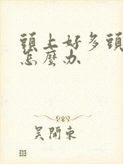 头上好多头皮屑怎么办