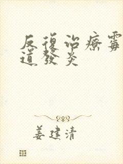 反复治疗霉菌阴道发炎