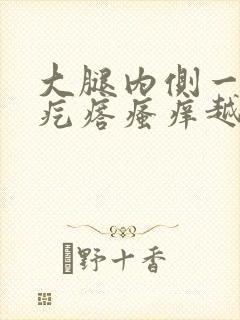 大腿内侧一片红疙瘩瘙痒越抓越痒封面