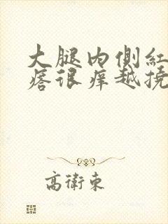 大腿内侧红色疙瘩很痒越挠越多