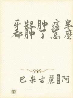 牙龈肿痛半边脸都肿了怎么快速消肿