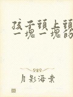 孩子头上头皮屑一块一块的怎么回事