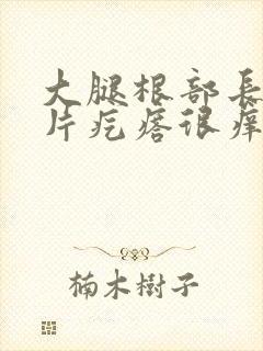 大腿根部长了一片疙瘩很痒