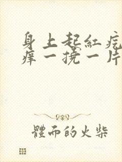 身上起红疙瘩很痒一挠一片封面