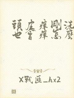 头皮痒刚洗完头也会痒怎么办